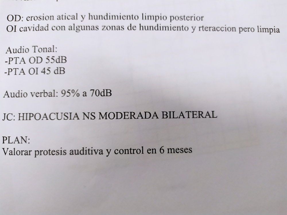 perdida audición y minusvalia